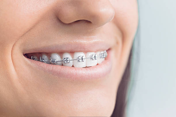 Best Traditional Braces  in Tornillo, TX